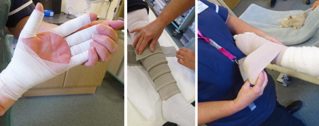 3 images with a hand, leg and foot wrapped in a bandage